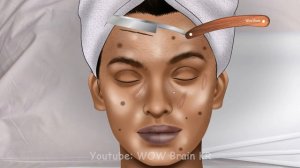 ASMR Help MrBeast Remove Wisdom Teeth | WOW Brain Kr Dental Care Video