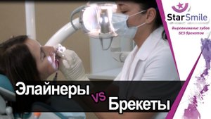 В элайнерах комфортно целоваться. В брекетах - нет!