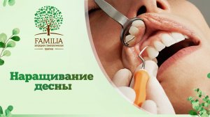 ? Наращивание десны