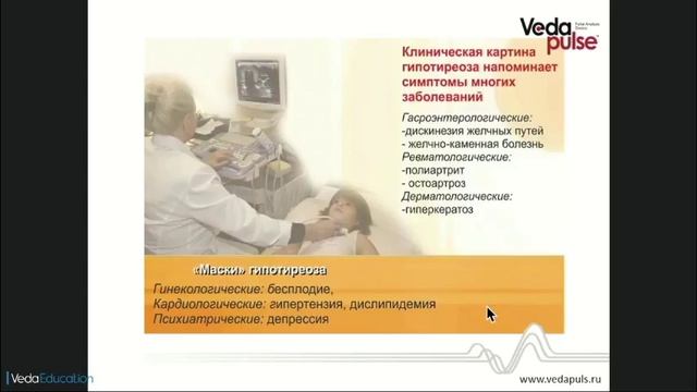 Нарушение функции щитовидной железы. Гипотиреоз