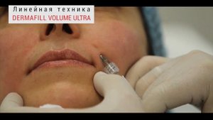 Линейная техника филлером