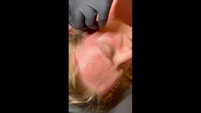 Gör min tragus piercing смотреть онлайн