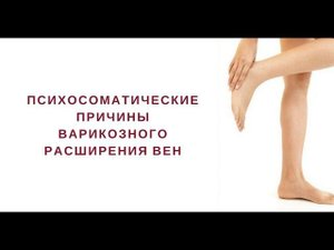 Психосоматические причины варикозного расширения вен