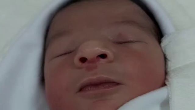 Case 677 visual initial newborn assessment capability hemangioma is not simple as you think, cause