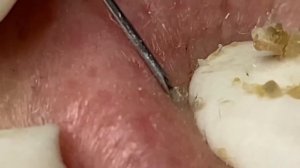 Enjoy Every Day With The Best Video Loan Nguyen Spa Official 2310