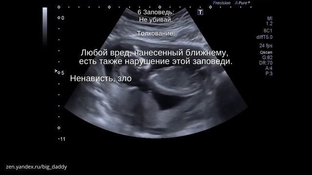 Шестая Заповедь Божья на русском языке с толкованием. смотреть онлайн