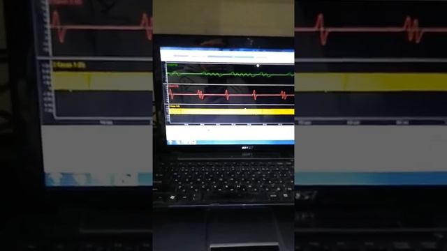 Nissan MAXIMA A32 VQ30DE 1998 года , НЕТ ОШИБОК, НЕТ ИСКРЫ ВО ВСЕХ ЦИЛИНДРАХ, ОСЦИЛЛОГРАФФ СИЛА :) смотреть онлайн