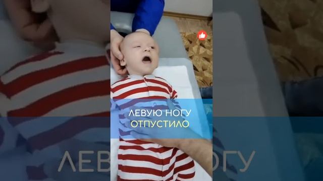 Младенцу 2 мес! Устранение родовой травмы Атланта. Акупрессура подзатылочных мышц #андреймалышев