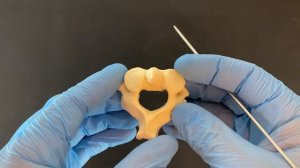 Осевой позвонок - Axis (анатомия человека)