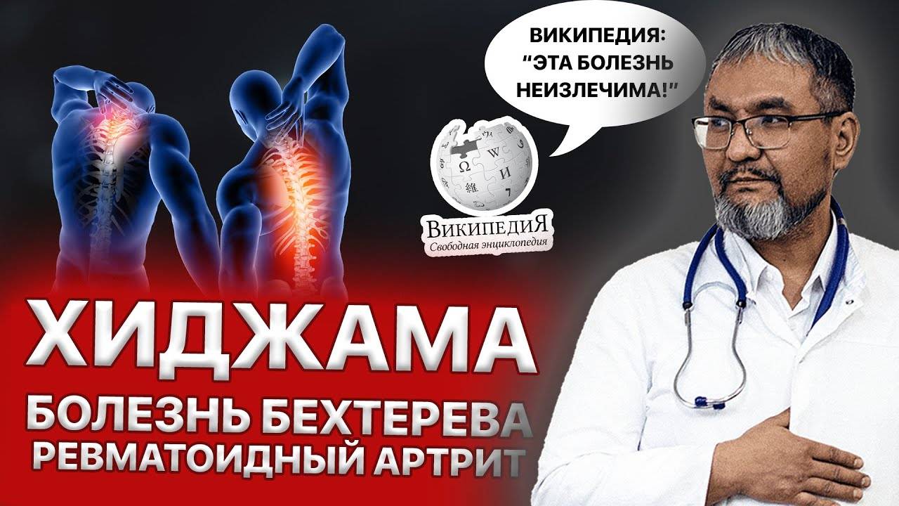 ХИДЖАМА: БОЛЕЗНЬ БЕХТЕРЕВА И РЕВМАТОИДНЫЙ АРТРИТ / ЛЕЧЕНИЕ ХИДЖАМОЙ / ПРИМЕРЫ ИЗ ОПЫТА