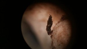 Ушной кошачий клещ под микроскопом