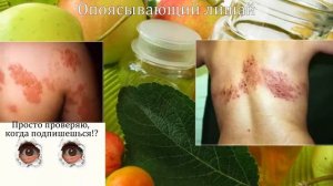 ЯБЛОЧНЫЙ УКСУС. 40 рецептов лечения яблочным уксусом