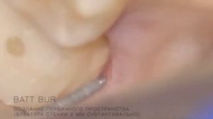 Вертипреп/Vertiprep выбор боров