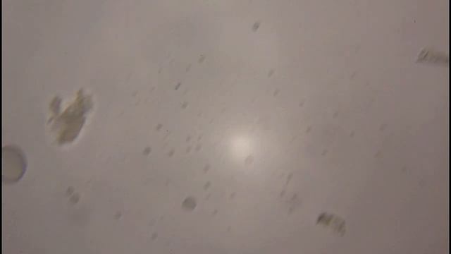Вода из родника под микроскопом