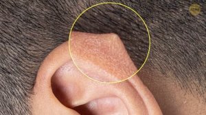 Факты о теле и редкие особенности, о которых вы, возможно, не знаете