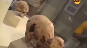 Сенсация  Древние артефакты потрясли учённый мир Люди боги Хирурги древности Эпоха вытянутых черепо