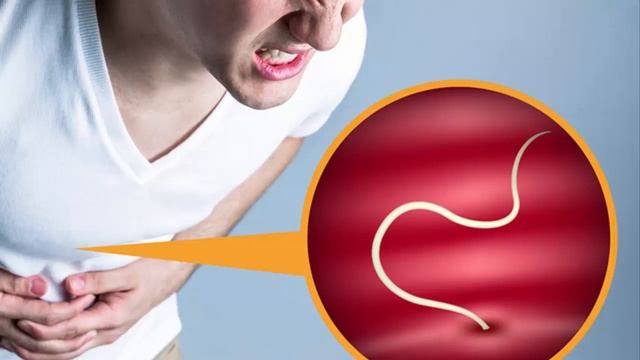 Глисты у человека, фото, симптомы, лечение Признаки гельминтоза смотреть онлайн