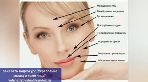 Жизнь лица и мозга зависит от тройничного нерва, но он часто сдавливается. Расслабьте Гассеров узел