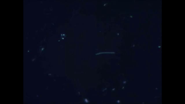 Бактерия под микроскопом. смотреть онлайн