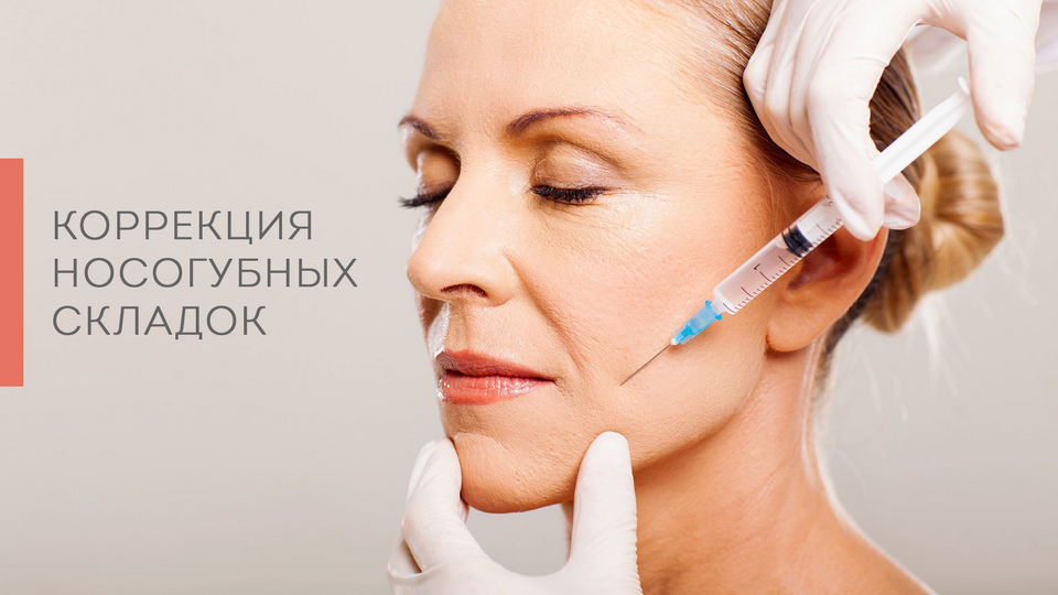 Коррекция носогубных складок