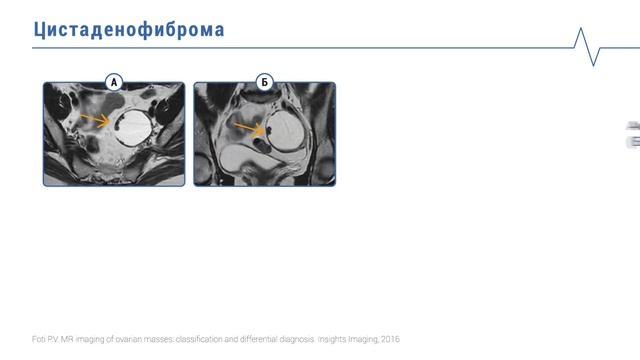 Особенности КТ и МРТ паренхиматозных органов малого таза