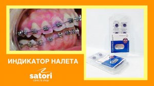 Профилактика кариеса – таблетки для окрашивания зубного налета _ индикатор налета