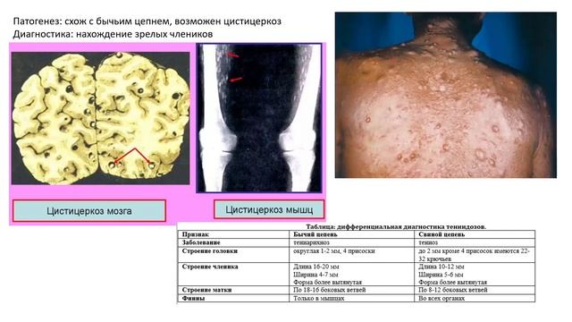 Экзамен по биологии | ЛЕНТОЧНЫЕ ЧЕРВИ. Бычий цепень. Свиной цепень. Широкий лентец