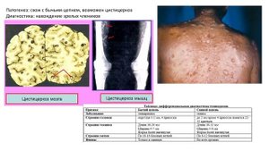 Экзамен по биологии | ЛЕНТОЧНЫЕ ЧЕРВИ. Бычий цепень. Свиной цепень. Широкий лентец