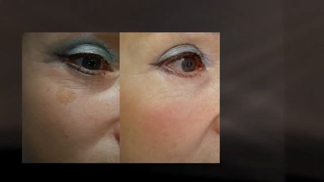 Lumiderm Осветляющий Пилинг Для Лица смотреть онлайн