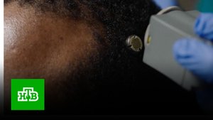 Чип в мозгу: на что способны люди-киборги | «Центральное телевидение»