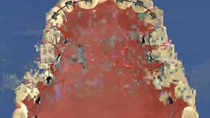 Ортодонтия Краснодар -  Расширение и придание формы - ДокторСтом