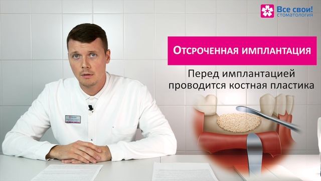 Методики имплантации зубов! ️Современная стоматология сократит время вашего лечения до 1 дня!
