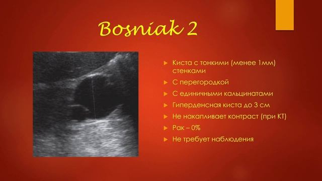УЗ-диагностика кист почек (подробно). УЗИ в урологии-2020 (минисерии) Станислав Феданов