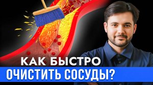 Можно Ли Очистить Сосуды В Домашних Условиях? Атеросклероза Больше НЕ БУДЕТ!