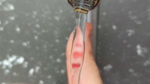 ПОЛУЧИЛ ОЖОГ ОТ РАСКАЛЕННОГО  УТЮГА. ПОСЛЕДСТВИЯ ОЖОГА