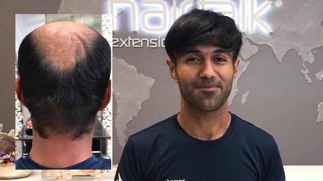 Отзыв мужчины о системе волос и о студии hairtalk смотреть онлайн