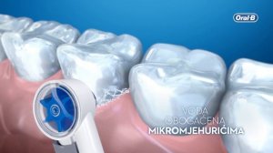 Oral-B Aquacare, Oralni tuš s tehnologijom Oxyjet