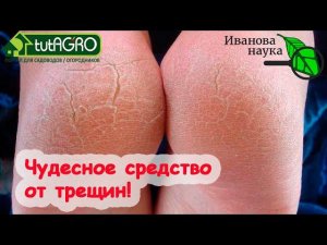 ЖИВАЯ ВОДА - НЕ СКАЗКА! Трещины на ПЯТКАХ, ГУБАХ и РУКАХ ЗАТЯГИВАЮТСЯ МИГОМ! Замечательное средство!