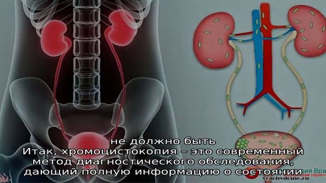 Хромоцистоскопия