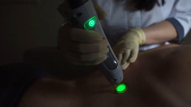 Лазерная эпиляция на аппарате Candela GentleLase Pro U