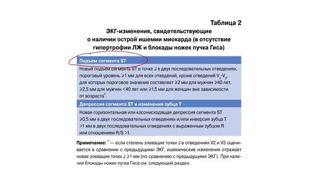 Паттерн де Винтера. Разбор ЭКГ от подписчика. Острый коронарный синдром без подъема сегмента ST.