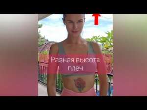 Разная высота плеч