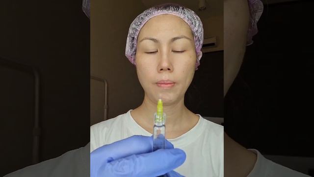 Mesotherapy at home using Hyaron
