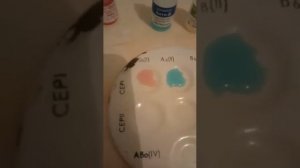 Определение группы крови и резус фактора экспресс-методом с использованием цоликлонов. Часть1.