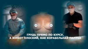 Якорная подтяжка груди и липомоделирование живота и боков для пациентки