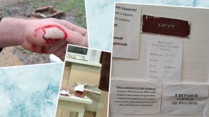 Без операции не обошлось.Сычёвская больница удивила...приятно..! Вот так отпуск - запомним навсегда