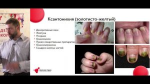 КРАСНАЯ ГОРКА 28 апреля 2023 Маруев Максим - Болезни ногтей и кожи
