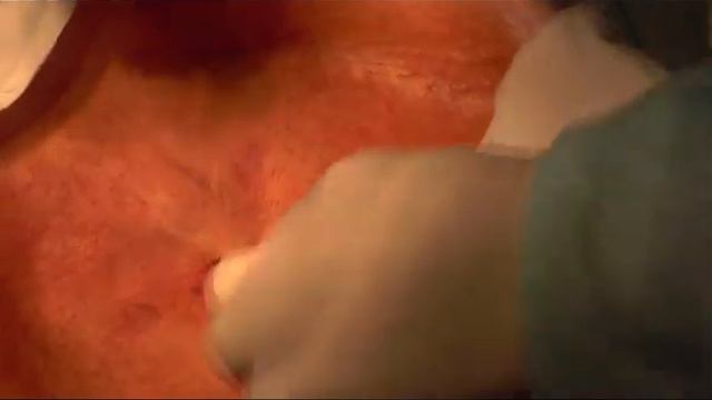 Медианная лапаротомия свинки. Midline laparotomy of female pig. Docent A.D. Stepanov, ПДАТУ смотреть онлайн