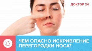 Чем опасно искривление НОСОВОЙ перегородки? | Доктор 24