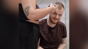 BALDING RECEDING Hairline 0 Buzz Cut Transformation At 24